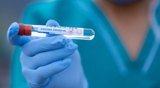 V ZD Brežice se tudi v novem letu nadaljuje cepljenje proti in testiranje na covid-19