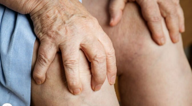 Artritis – kaj je, zakaj nastane in kako ga odpraviti?