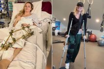 Lindsey Vonn hkrati s sestro okreva zaradi strgane križne vezi