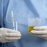 Lab doctor performing medical exam urine