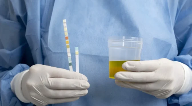 Lab doctor performing medical exam urine